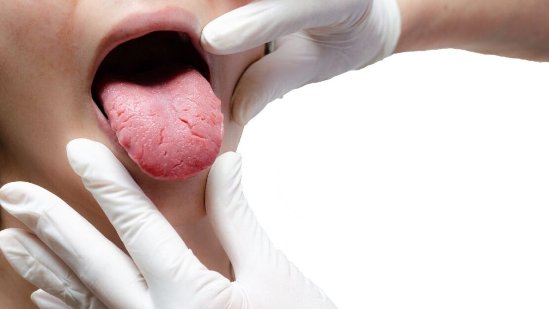 Doctor examining patient's tongue for side pain during dental evaluation.