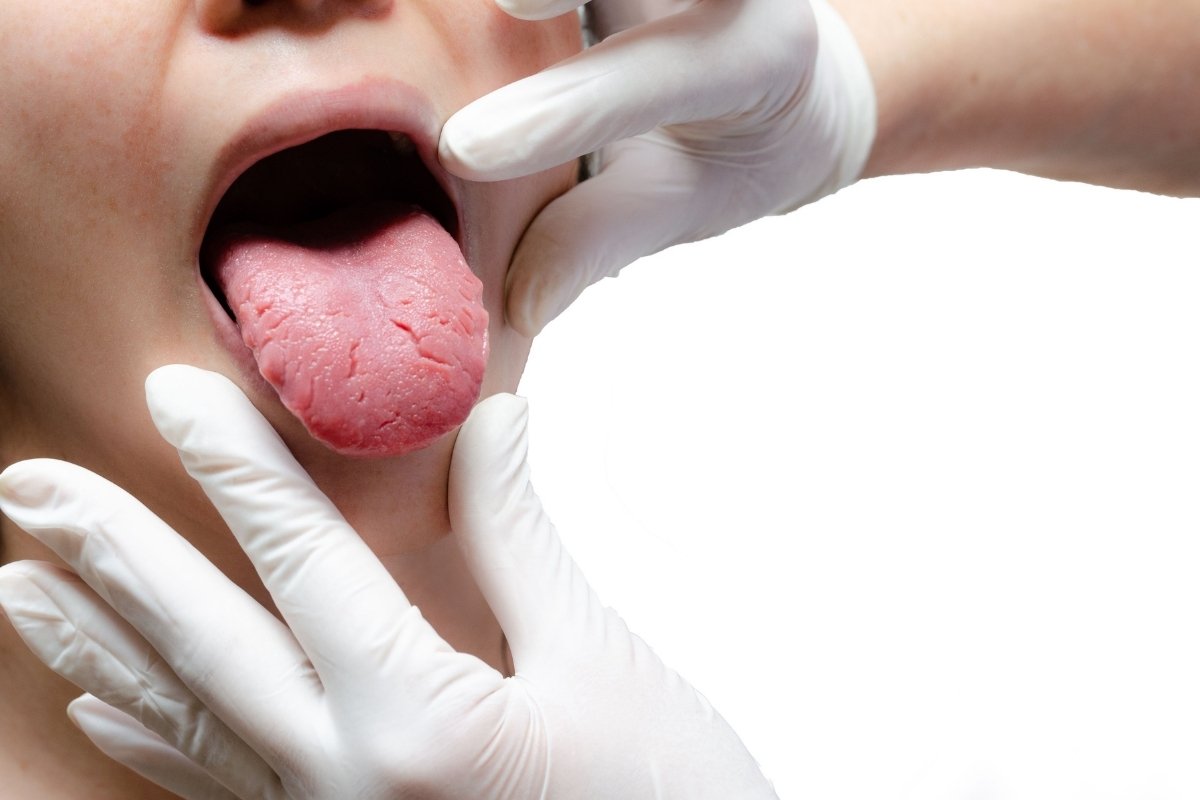 Why Does My Tongue Hurt on the Side? Causes & Relief