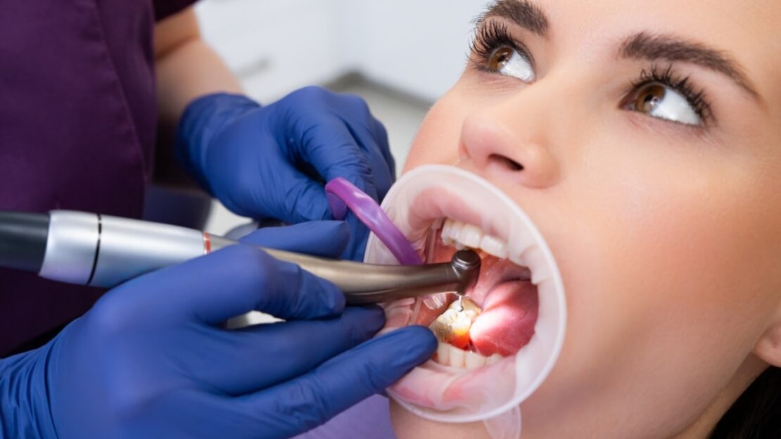 Dentist using laser treatment to remove tooth stains during cosmetic dental procedure.